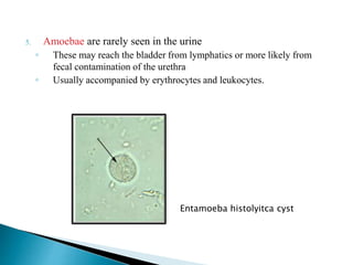 5. Amoebae are rarely seen in the urine
◦ These may reach the bladder from lymphatics or more likely from
fecal contamination of the urethra
◦ Usually accompanied by erythrocytes and leukocytes.
Entamoeba histolyitca cyst
 
