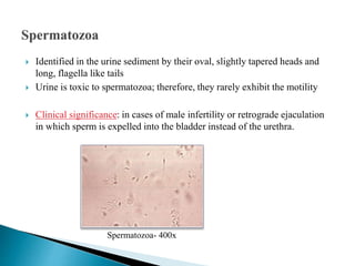  Identified in the urine sediment by their oval, slightly tapered heads and
long, flagella like tails
 Urine is toxic to spermatozoa; therefore, they rarely exhibit the motility
 Clinical significance: in cases of male infertility or retrograde ejaculation
in which sperm is expelled into the bladder instead of the urethra.
Spermatozoa- 400x
 