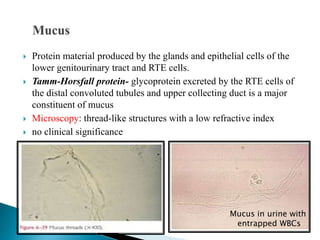  Protein material produced by the glands and epithelial cells of the
lower genitourinary tract and RTE cells.
 Tamm-Horsfall protein- glycoprotein excreted by the RTE cells of
the distal convoluted tubules and upper collecting duct is a major
constituent of mucus
 Microscopy: thread-like structures with a low refractive index
 no clinical significance
Mucus in urine with
entrapped WBCs
 
