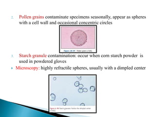 2. Pollen grains contaminate specimens seasonally, appear as spheres
with a cell wall and occasional concentric circles
3. Starch granule contamination: occur when corn starch powder is
used in powdered gloves
 Microscopy: highly refractile spheres, usually with a dimpled center
 