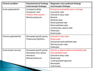 Clinical condition Physiochemical Findings
(macroscopic findings)
Diagnostic urine sediment findings
(microscopic findings)
Acute pyelonephritis Increased turbidity
Occasional `odor`
Positive nitrite reaction
Minimal proteinuria
Numerous neutrophils( many in clumps)
Leucocytic casts
Granular & waxy casts
Bacteria
Bacterial casts
Renal epithelial cells
Renal epithelial casts
Lymphocytes, plasma cells,
Histiocytes
Erythrocytes
Chronic pyelonephritis Decreased specific gravity
Proteinuria(>2g/24hrs)
Granular & waxy casts
Broad casts
Occasional renal epithelial casts
Rare leucocytic casts
histiocytes
Acute tubular necrosis Decreased specific gravity
Decreased urine volume
Hematuria
Minimal proteinuria
Necrotic or degenerated renal epithelial cells
renal epithelial casts
Granular & waxy casts
Broad casts
renal epithelial fragments
Neutrophils
erythrocytes
 