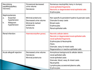 Necrotising
papillitis(papillary
necrosis)
Occasional decreased
urine volume
Hematuria
Numerous neutrophils( many in clumps)
renal epithelial fragments
Necroritc or degenerated renal epithelial cells
Erythrocytes
Nephrosclerosis
a. Essential
hypertension
b. Malignant
hypertension
Minimal proteinuria
Decreased urine volume
Minimal & marked
proteinuria
hematuria
Non specific & persistent hyaline & granular casts
Granular & waxy casts
Broad casts
Erythrocytes
Renal epithelial cells
Renal infarction Haematuria(often gross) Necrotic cellular debris
Necrotic or degenerated renal epithelial cells
renal epithelial fragments
Erythrocytes & Neutrophils
Fibrin
Granular, waxy & mixed casts
Regenerative or reactive epithelial cells
Acute allograft rejection Decreased urine volume
Hematuria
Minimal proteinuria
Amorphous background & cellular debris
renal epithelial cells
renal epithelial casts
Granular, blood, waxy & mixed casts
Neutrophils
Lymphocytes,occasional plasma cells,
Erythrocytes
 