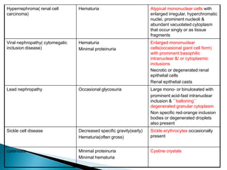 Hypernephroma( renal cell
carcinoma)
Hematuria Atypical mononuclear cells with
enlarged irregular, hyperchromatic
nuclei, prominent nucleoli &
abundant vacuolated cytoplasm
that occur singly or as tissue
fragments
Viral nephropathy( cytomegalic
inclusion disease)
Hematuria
Minimal proteinuria
Enlarged mononuclear
cells(occasional giant cell form)
with prominent basophilic
intranuclear &/ or cytoplasmic
inclusions
Necrotic or degenerated renal
epithelial cells
Renal epithelial casts
Lead nephropathy Occasional glycosuria Large mono- or binulceated with
prominent acid-fast intranuclear
inclusion & ``balloning``
degenerated granular cytoplasm
Non specific red-orange inclusion
bodies or degenerated droplets
also present
Sickle cell disease Decreased specific gravity(early)
Hematuria(often gross)
Sickle erythrocytes occasionally
present
cystinosis Minimal proteinuria
Minimal hematuria
Cystine crystals
 