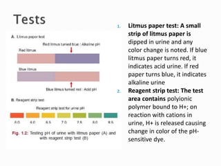 1. Litmus paper test: A small
strip of litmus paper is
dipped in urine and any
color change is noted. If blue
litmus paper turns red, it
indicates acid urine. If red
paper turns blue, it indicates
alkaline urine
2. Reagent strip test: The test
area contains polyionic
polymer bound to H+; on
reaction with cations in
urine, H+ is released causing
change in color of the pH-
sensitive dye.
 
