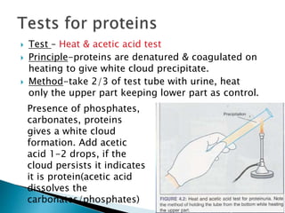  Test – Heat & acetic acid test
 Principle-proteins are denatured & coagulated on
heating to give white cloud precipitate.
 Method-take 2/3 of test tube with urine, heat
only the upper part keeping lower part as control.
Presence of phosphates,
carbonates, proteins
gives a white cloud
formation. Add acetic
acid 1-2 drops, if the
cloud persists it indicates
it is protein(acetic acid
dissolves the
carbonates/phosphates)
 