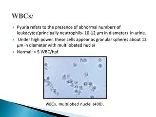  Pyuria refers to the presence of abnormal numbers of
leukocytes(principally neutrophils- 10-12 μm in diameter) in urine.
 Under high power, these cells appear as granular spheres about 12
μm in diameter with multilobated nuclei
 Normal: < 5 WBC/hpf
WBCs. multilobed nuclei (400).
 