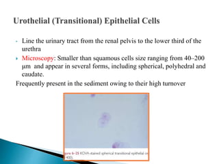 • Line the urinary tract from the renal pelvis to the lower third of the
urethra
 Microscopy: Smaller than squamous cells size ranging from 40–200
μm and appear in several forms, including spherical, polyhedral and
caudate.
Frequently present in the sediment owing to their high turnover
 