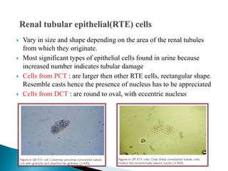  Vary in size and shape depending on the area of the renal tubules
from which they originate.
 Most significant types of epithelial cells found in urine because
increased number indicates tubular damage
 Cells from PCT : are larger then other RTE cells, rectangular shape.
Resemble casts hence the presence of nucleus has to be appreciated
 Cells from DCT : are round to oval, with eccentric nucleus
 