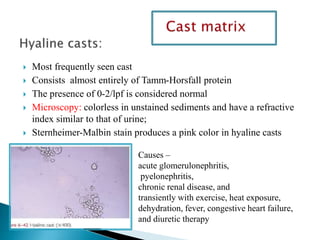  Most frequently seen cast
 Consists almost entirely of Tamm-Horsfall protein
 The presence of 0-2/lpf is considered normal
 Microscopy: colorless in unstained sediments and have a refractive
index similar to that of urine;
 Sternheimer-Malbin stain produces a pink color in hyaline casts
Causes –
acute glomerulonephritis,
pyelonephritis,
chronic renal disease, and
transiently with exercise, heat exposure,
dehydration, fever, congestive heart failure,
and diuretic therapy
 