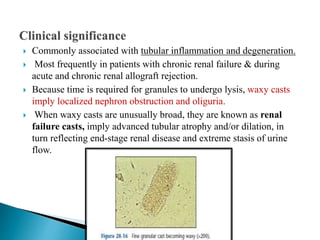  Commonly associated with tubular inflammation and degeneration.
 Most frequently in patients with chronic renal failure & during
acute and chronic renal allograft rejection.
 Because time is required for granules to undergo lysis, waxy casts
imply localized nephron obstruction and oliguria.
 When waxy casts are unusually broad, they are known as renal
failure casts, imply advanced tubular atrophy and/or dilation, in
turn reflecting end-stage renal disease and extreme stasis of urine
flow.
 