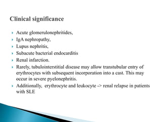  Acute glomerulonephritides,
 IgA nephropathy,
 Lupus nephritis,
 Subacute bacterial endocarditis
 Renal infarction.
 Rarely, tubulointerstitial disease may allow transtubular entry of
erythrocytes with subsequent incorporation into a cast. This may
occur in severe pyelonephritis.
 Additionally, erythrocyte and leukocyte -> renal relapse in patients
with SLE
 