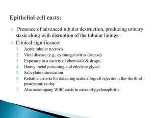  Presence of advanced tubular destruction, producing urinary
stasis along with disruption of the tubular linings.
 Clinical significance:
1. Acute tubular necrosis
2. Viral disease (e.g., cytomegalovirus disease)
3. Exposure to a variety of chemicals & drugs.
4. Heavy metal poisoning and ethylene glycol
5. Salicylate intoxication
6. Reliable criteria for detecting acute allograft rejection after the third
postoperative day
7. Also accompany WBC casts in cases of pyelonephritis
 