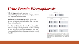 Urine Protein Electrophoresis
Selective proteinuria- passage of
comparatively lower molecular weight proteins
like albumin and transferrin
Nonselective proteinuria-larger molecular
weight proteins (γ globulins) are also excreted
along with albumin
Tubular proteinuria: low molecular weight
proteins like β2-microglobulin, retinol-binding
protein, lysozyme, α1-microglobulin, and free
immunoglobulin light chains(prominent α- and
βbands)
 