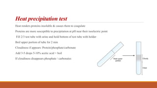 Heat precipitation test
Heat renders proteins insoluble & causes them to coagulate
Proteins are more susceptible to precipitation at pH near their isoelectric point
Fill 2/3 test tube with urine and hold bottom of test tube with holder
Boil upper portion of tube for 2 min
Cloudiness if appears: Protein/phosphate/carbonate
Add 3-5 drops 5-10% acetic acid + boil
If cloudiness disappears phosphate / carbonates
 