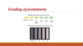 Grading of proteinuria
 