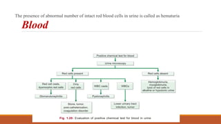 Blood
The presence of abnormal number of intact red blood cells in urine is called as hematuria
 