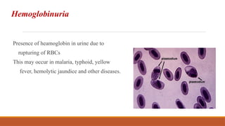 Hemoglobinuria
Presence of heamoglobin in urine due to
rupturing of RBCs
This may occur in malaria, typhoid, yellow
fever, hemolytic jaundice and other diseases.
 