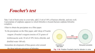 Fouchet’s test
Take 5 ml of fresh urine in a test tube, add 2.5 ml of 10% of barium chloride, and mix well.
A precipitate of sulphates appears to which bilirubin is bound (barium sulphate-bilirubin
complex).
Filter to obtain the precipitate on a filter paper.
To the precipitate on the filter paper, add 1drop of Fouchet’s
reagent. (Fouchet’s reagent consists of 25 grams of
trichloroacetic acid, 10 ml of 10% ferric chloride, and
distilled water 100 ml).
Immediate development of blue-green color around
the drop indicates presence of bilirubin
 