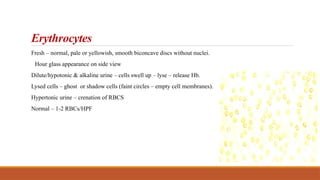 Erythrocytes
Fresh – normal, pale or yellowish, smooth biconcave discs without nuclei.
Hour glass appearance on side view
Dilute/hypotonic & alkaline urine – cells swell up – lyse – release Hb.
Lysed cells – ghost or shadow cells (faint circles – empty cell membranes).
Hypertonic urine – crenation of RBCS
Normal – 1-2 RBCs/HPF
 