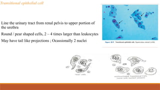 Transitional epithelial cell
Line the urinary tract from renal pelvis to upper portion of
the urethra
Round / pear shaped cells, 2 – 4 times larger than leukocytes
May have tail like projections ; Ocassionally 2 nuclei
 