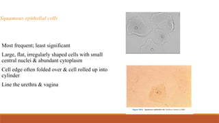 Squamous epithelial cells
Most frequent; least significant
Large, flat, irregularly shaped cells with small
central nuclei & abundant cytoplasm
Cell edge often folded over & cell rolled up into
cylinder
Line the urethra & vagina
 