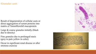 Granular casts
Result of degeneration of cellular casts or
direct aggregation of serum proteins into
matrix of TammHorsfall mucoprotein
Large & coarse granules initially (black
due to density)
Fine granules due to prolonged stasis
(grey to pale yellow in color)
Occur in significant renal disease or after
strenous exercise
 