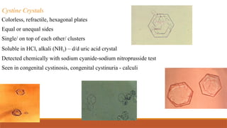 Cystine Crystals
Colorless, refractile, hexagonal plates
Equal or unequal sides
Single/ on top of each other/ clusters
Soluble in HCl, alkali (NH3) – d/d uric acid crystal
Detected chemically with sodium cyanide-sodium nitroprusside test
Seen in congenital cystinosis, congenital cystinuria - calculi
 