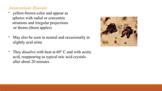 Ammonium Biurate
- yellow-brown color and appear as
spheres with radial or concentric
striations and irregular projections
or thorns (thorn apples)
- May also be seen in neutral and occasionally in
slightly acid urine
- They dissolve with heat at 60° C and with acetic
acid, reappearing as typical uric acid crystals
after about 20 minutes
 