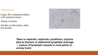 Cholesterol
Large, flat, transparent plates
with notched corners
Variety of colors
Soluble in chloroform, ether,
hot alcohol
•Seen in nephritis, nephrotic conditions, chyluria
(due to thoracic or abdominal lymphatic drainage
– rupture of lymphatic vessels in renal pelvis or
urinary tract)
 