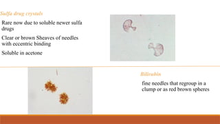 Sulfa drug crystals
Rare now due to soluble newer sulfa
drugs
Clear or brown Sheaves of needles
with eccentric binding
Soluble in acetone
Bilirubin
fine needles that regroup in a
clump or as red brown spheres
 