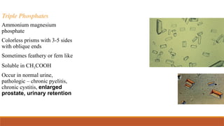 Triple Phosphates
Ammonium magnesium
phosphate
Colorless prisms with 3-5 sides
with oblique ends
Sometimes feathery or fern like
Soluble in CH3COOH
Occur in normal urine,
pathologic – chronic pyelitis,
chronic cystitis, enlarged
prostate, urinary retention
 