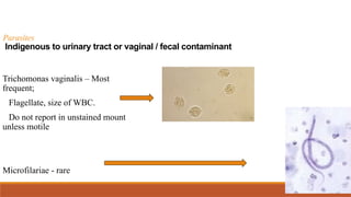 Parasites
Indigenous to urinary tract or vaginal / fecal contaminant
Trichomonas vaginalis – Most
frequent;
Flagellate, size of WBC.
Do not report in unstained mount
unless motile
Microfilariae - rare
 