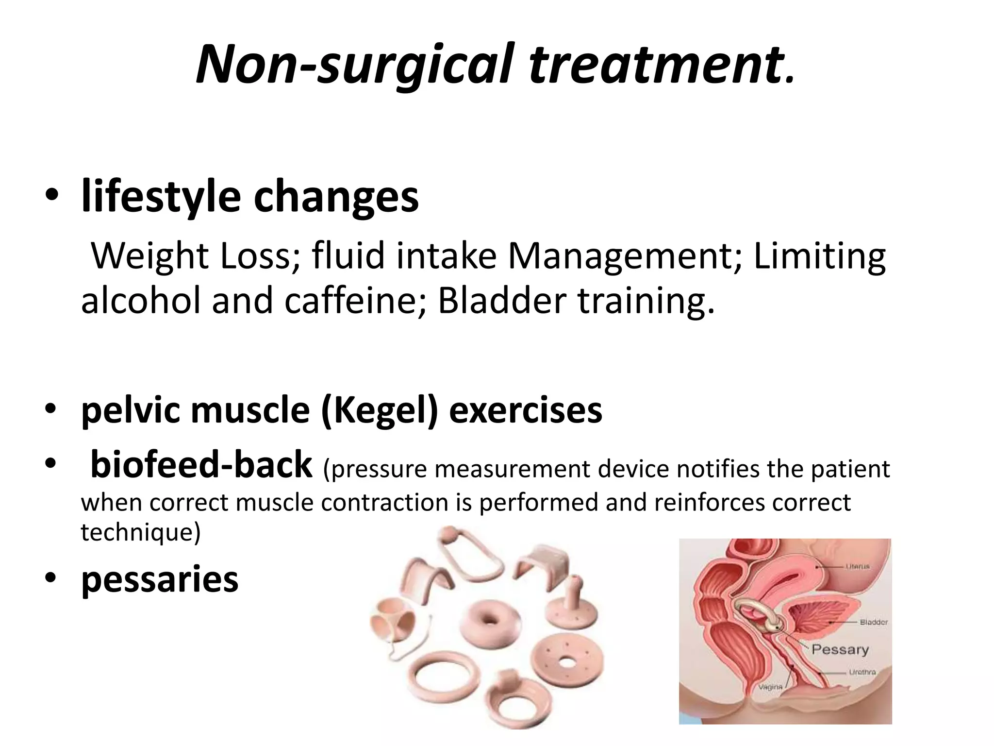 Non-surgical treatment.
• lifestyle changes
Weight Loss; fluid intake Management; Limiting
alcohol and caffeine; Bladder training.
• pelvic muscle (Kegel) exercises
• biofeed-back (pressure measurement device notifies the patient
when correct muscle contraction is performed and reinforces correct
technique)
• pessaries
 
