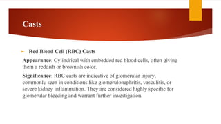 Disentagrating Rbc Cast Comprehensive Urine Microscopy and Urinalysis Techniques and ...