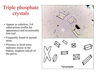Triple phosphate
crystals
• Appear as colorless, 3-6
sided prisms (coffin lid
appearance) and occasionally
fern leaf.
• Fr...