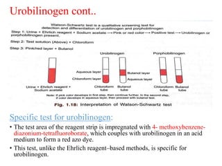 Urobilinogen cont..
Specific test for urobilinogen:
• The test area of the reagent strip is impregnated with 4- methoxyben...
