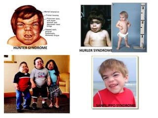 HUNTER SYNDROME
HURLER SYNDROME
SANFILIPPO SYNDROME
 