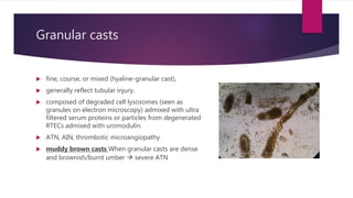 Urine sediment examination in the diagnosis and management | PPTX