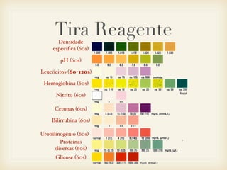Tira ReagenteDensidade
especíﬁca (60s)
pH (60s)
Leucócitos (60-120s)
Hemoglobina (60s)
Nitrito (60s)
Cetonas (60s)
Bilirrubina (60s)
Urobilinogênio (60s)
Proteínas
diversas (60s)
Glicose (60s)
 