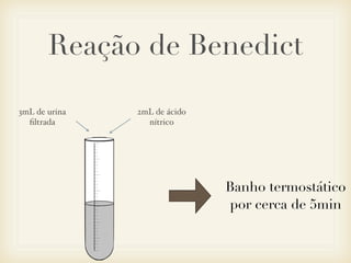 Reação de Benedict
2mL de ácido
nítrico
3mL de urina
ﬁltrada
Banho termostático
por cerca de 5min
 