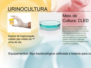 URINOCULTURA
                                       Meio de
                                       Cultura: CLED
                                       Agar de cistina lactose deficiente em
                                       eletrólitos) é um meio de cultura para
                                       diferenciação para utilizar no isolamento
                                       e enumeração de bactérias da urina.
                                       Este meio suporta o crescimento de
Depois da higienização                 agentes patogénicos e contaminantes
coletar jato médio da 1ª               urinários, mas evita a proliferação
urina do dia                           indevida de espécies de Proteus devido
                                       a ausência de eletrólitos.




Equipamentos: Alça bacteriológica calibrada e bateria para co
 