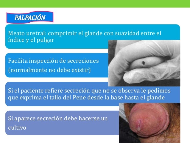 Hay cuanto una pompa para el aumento del miembro
