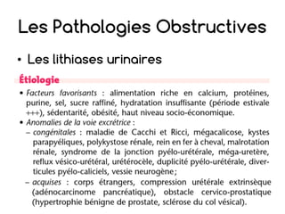 Les Pathologies Obstructives
• Les lithiases urinaires
 