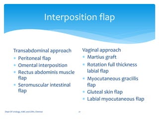 Interposition Flap Uro gynacology- radiation f. | PDF