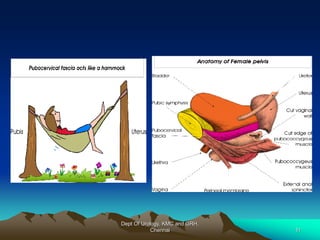 Dept Of Urology, KMC and GRH,
Chennai 11
 