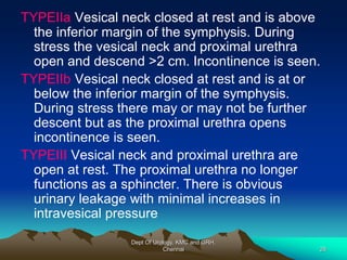 TYPEIIa Vesical neck closed at rest and is above
the inferior margin of the symphysis. During
stress the vesical neck and proximal urethra
open and descend >2 cm. Incontinence is seen.
TYPEIIb Vesical neck closed at rest and is at or
below the inferior margin of the symphysis.
During stress there may or may not be further
descent but as the proximal urethra opens
incontinence is seen.
TYPEIII Vesical neck and proximal urethra are
open at rest. The proximal urethra no longer
functions as a sphincter. There is obvious
urinary leakage with minimal increases in
intravesical pressure
Dept Of Urology, KMC and GRH,
Chennai 28
 