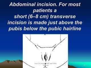 Abdominal incision. For most
patients a
short (6–8 cm) transverse
incision is made just above the
pubis below the pubic hairline
Dept Of Urology, KMC and GRH,
Chennai 54
 