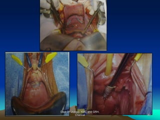 Dept Of Urology, KMC and GRH,
Chennai 80
 