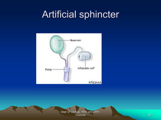 Artificial sphincter
Dept Of Urology, KMC and GRH,
Chennai 82
 
