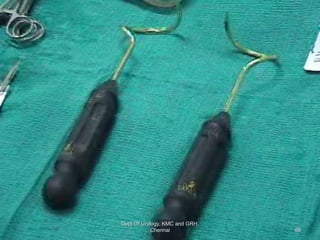 Dept Of Urology, KMC and GRH,
Chennai 88
 